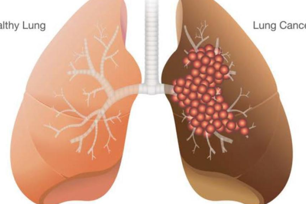 Photo: A*STAR’s Genome Institute of Singapore