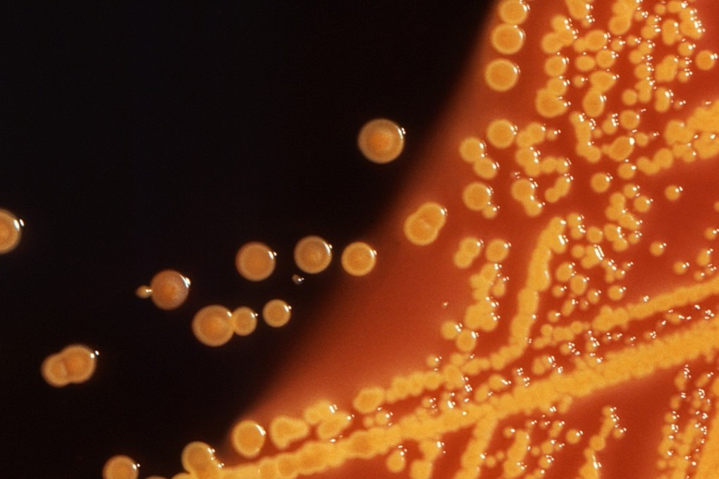 Colonies of E coli bacteria grown on a Hektoen enteric (HE) agar plate are seen in a microscopic image courtesy of the US Centre for Disease Control (CDC). Photo: CDC via Reuters