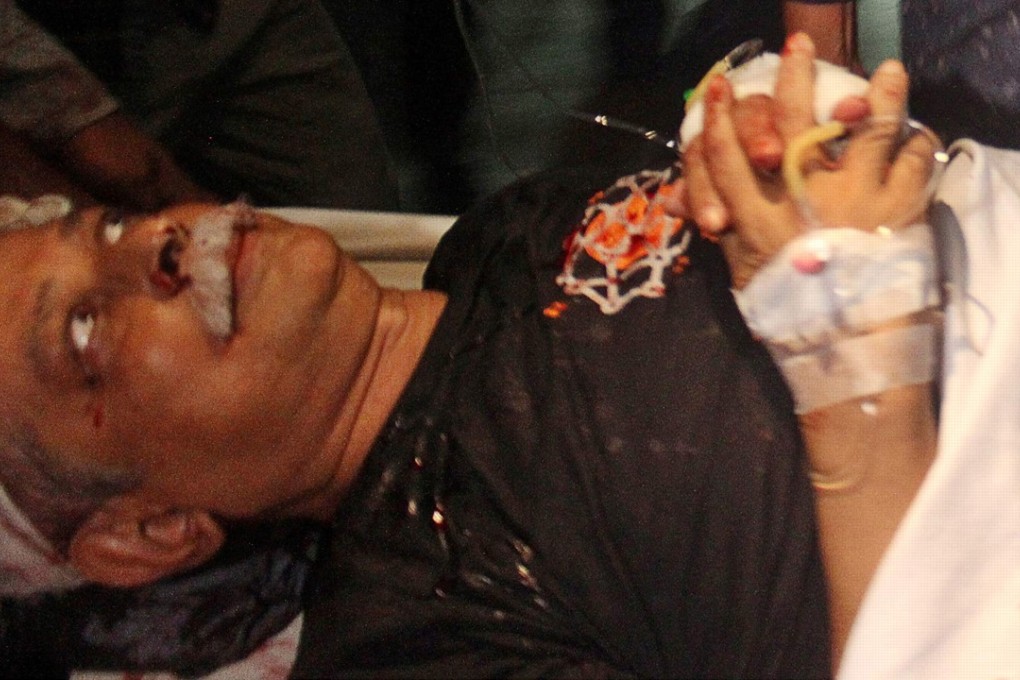 Zafar Iqbal, activist and bestselling science fiction writer lies on a stretcher at Sylhet MAG Osmani Medical College after he was stabbed in the head. Photo: AFP