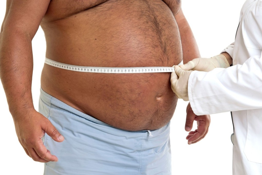 The obesity paradox has been debunked: being overweight or obese is no protection against heart disease. Photo: Alamy