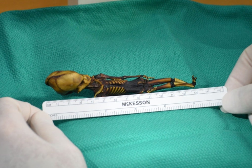 This undated image courtesy of Dr Emery Smith show a tiny, mummified skeleton discovery in 2003 in Chile's Atacama Desert, tucked into a leather pouch behind a church. Photo: Agence France-Presse