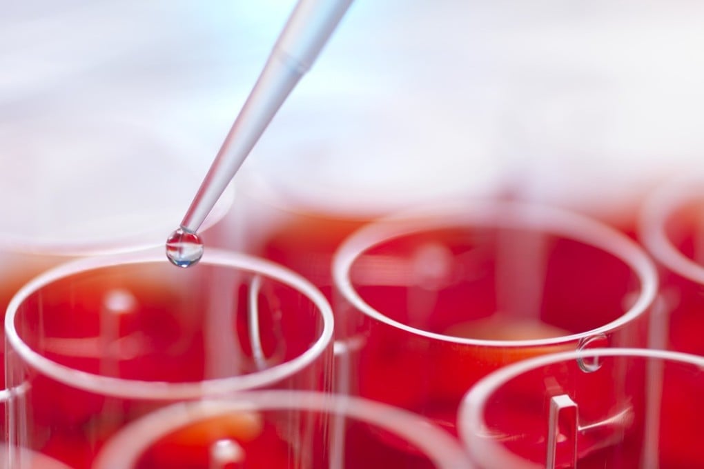 Authorities are looking to submit an amendment bill for the Pharmacy and Poisons Ordinance to Legco next year, which would regulate services such as blood transfusion therapies. Photo: Andrew Brookes/ Corbis