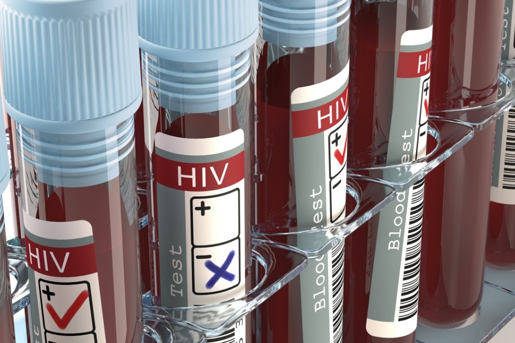 An investigation was launched in Russia on Monday into the death of a five-month-old HIV-positive baby whose mother refused her treatment because she believed the virus was a “myth”. Photo: Shutterstock