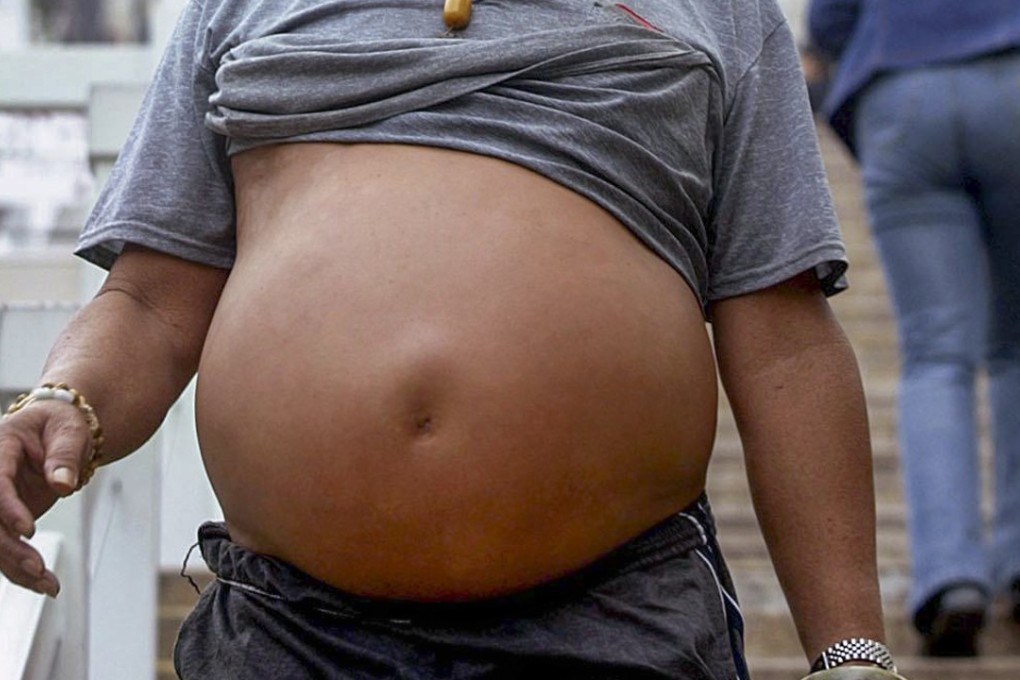 According to a recent survey, more than half of Hongkongers between the ages of 15 and 84 are overweight or obese – a risk factor for developing diabetes, which is linked to cancer. Photo: AFP