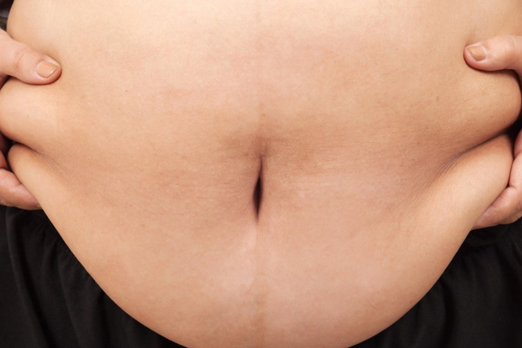 The number of overweight children under five rose 38 per cent between 2000 and 2016 in Asia-Pacific. Photo: Handout