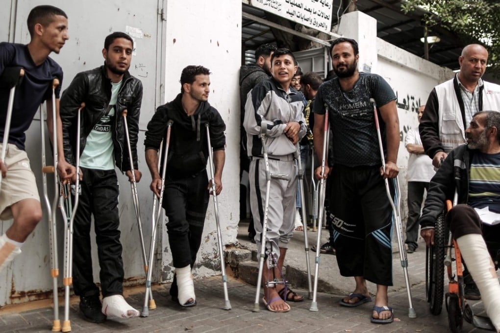 Palestinians, wounded in previous weeks during mass protests, await a medical check-up. Photo: AFP