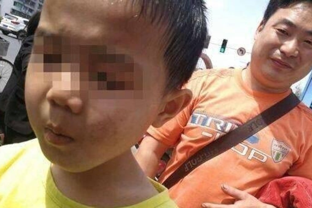 The seven-year-old boy remained in hospital but opinion on the attack included criticism of him and his parents. Photo: Weibo