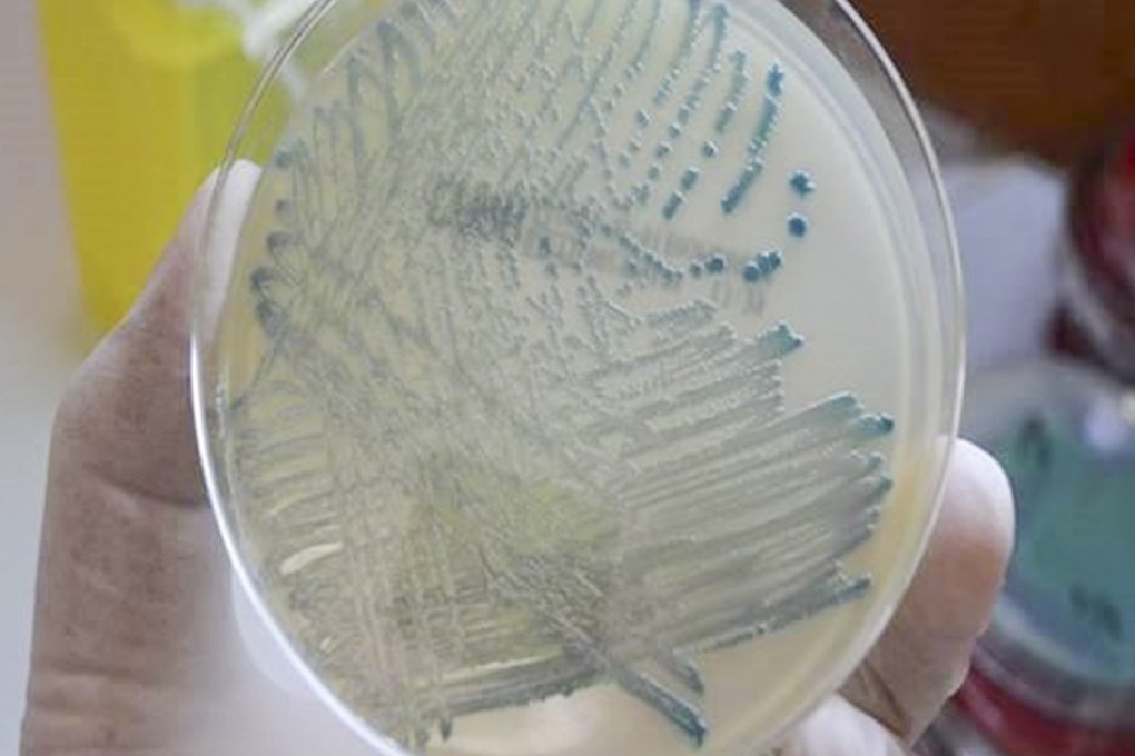 The number of patients detected with CPE was 473 last year, up from 340 in 2016. Photo: Hospital Authority