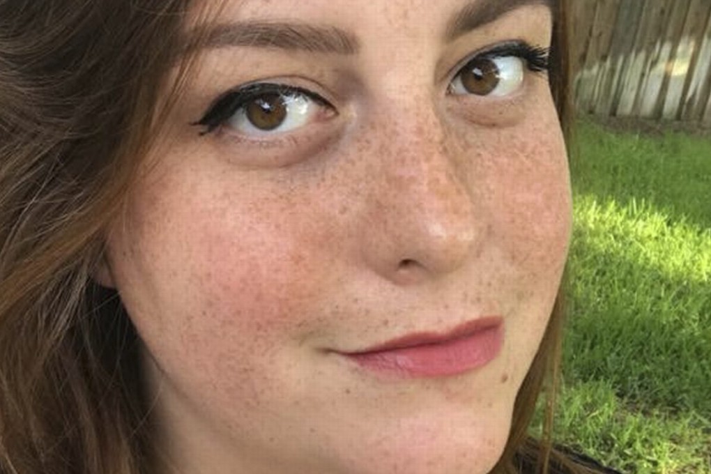 After trying to extract a cockroach that had lodged in her ear, Katie Holley had to seek medical attention three times before the whole thing was removed. Photo: AP