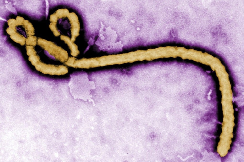 An electron micrograph image of the Ebola virus that has just killed 17 in the Democratic Republic of Congo in a new and frightening outbreak. Photo: AP
