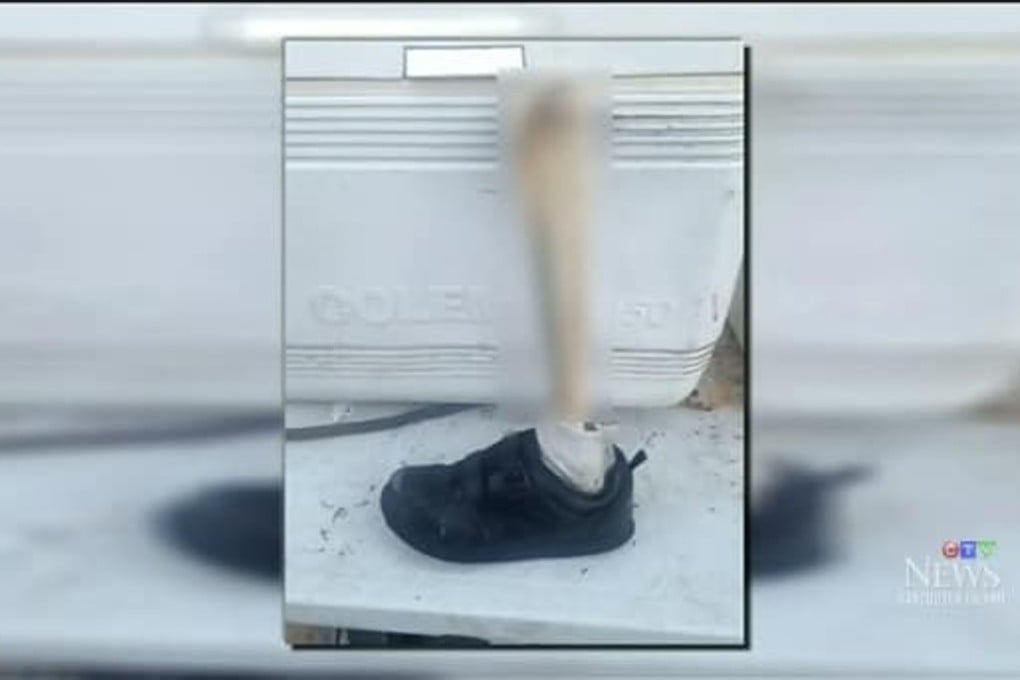 A human foot, still in a sneaker and with a leg bone attached, that was found on Vancouver Island last December by Mike Johns. Photo: Mike Johns / CTV Vancouver Island