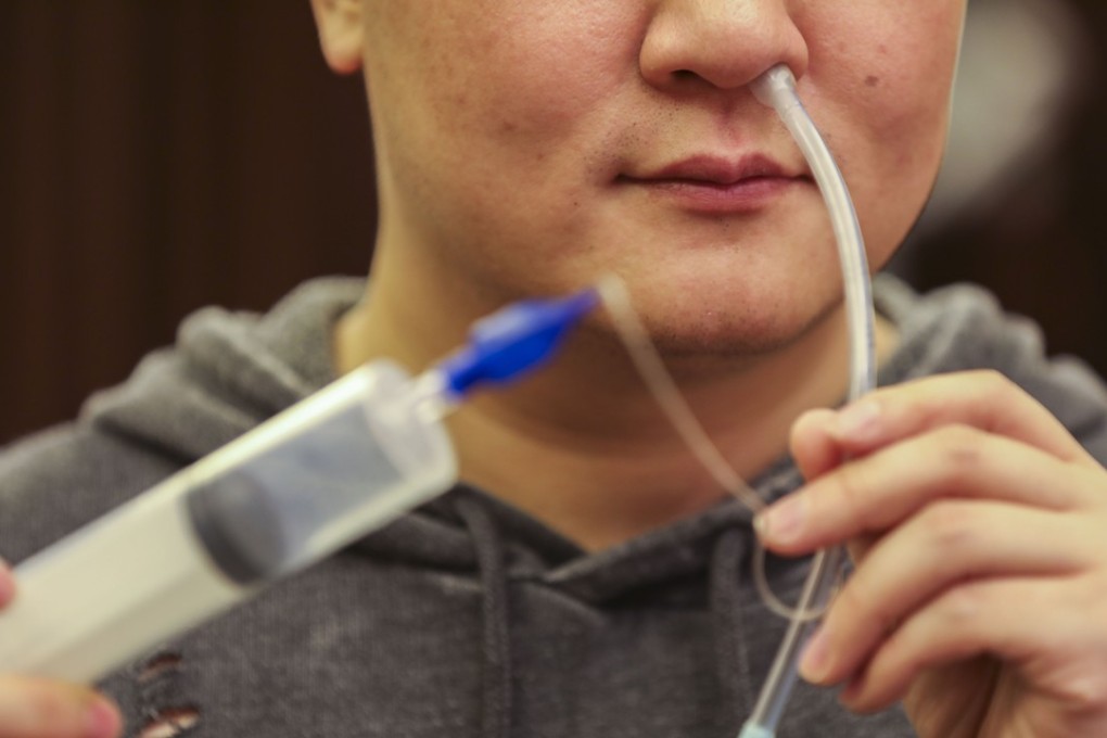 Derek Chan shows the tube he rigged up to get rid of his sleep apnoea, one of several forms of self-medication he adopted to rid himself of that condition and of depression. Photo: Simon Song
