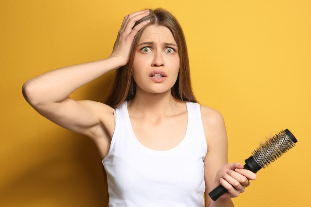 A study has warned that eating bitter pumpkins and squashes might lead to hair loss after two women suffered poisonings that rendered them mostly bald. Photo: Shutterstock