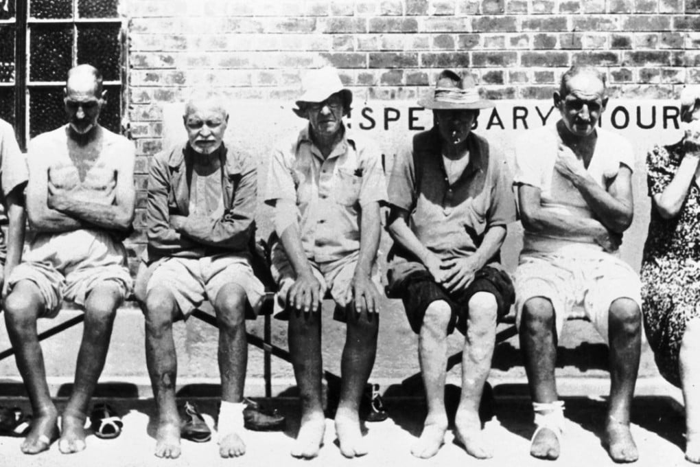 Undernourished prisoners of war at Stanley Internment Camp during the Japanese occupation of Hong Kong.