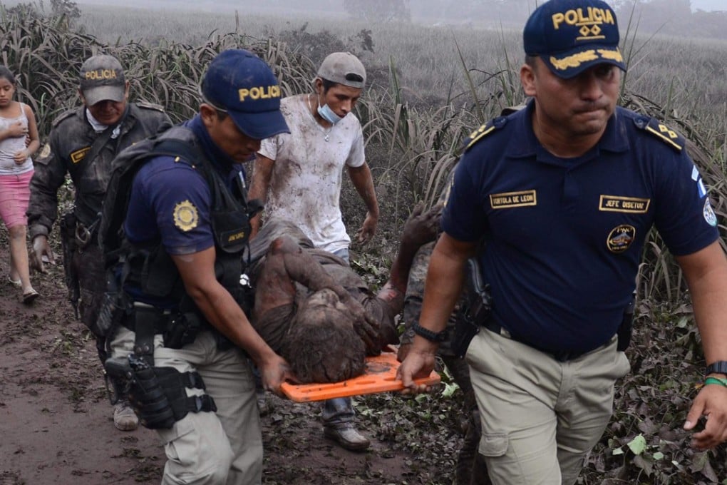 Police carry a wounded man after the eruption of Fuego Volcano, in El Rodeo village, south of Guatemala City. Photo: AFP