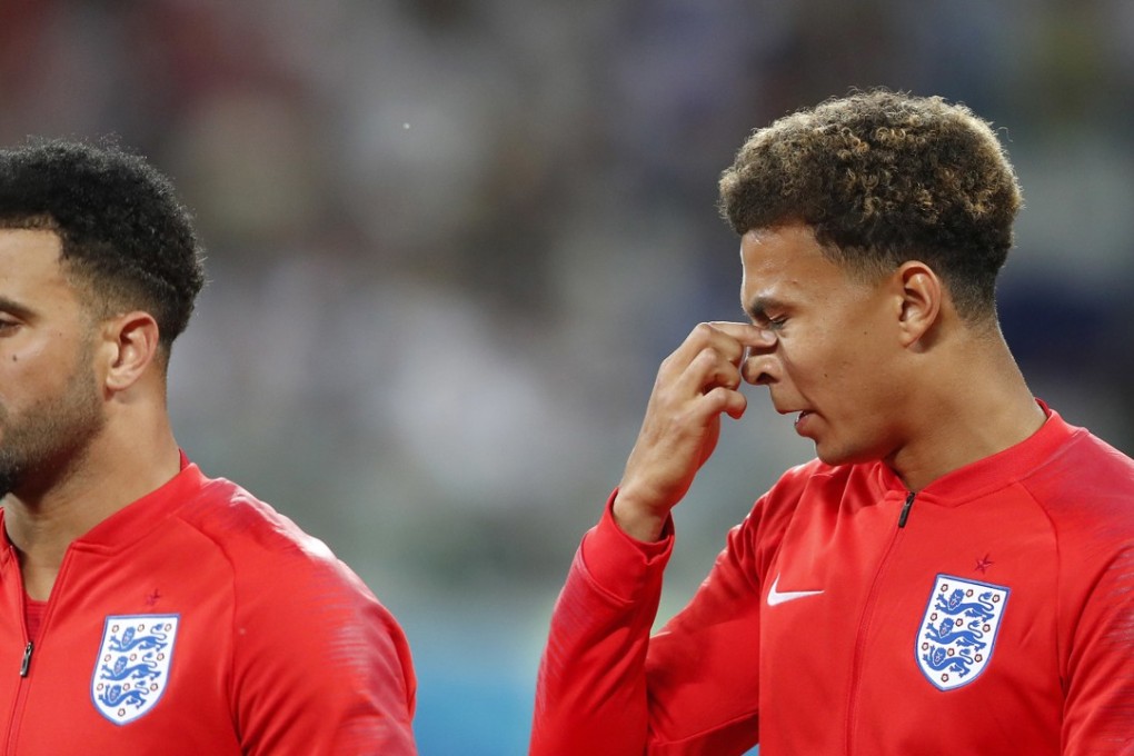 England’s Dele Alli (right) reacts to flies during the national anthem. Photo: AP