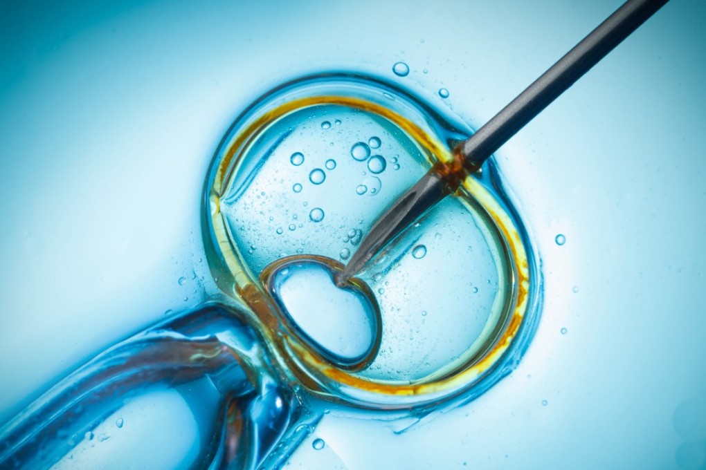 According to a recent study, the screening technology helped to minimise the miscarriage rate in IVF cases from 39 per cent to 2.7 per cent. Photo: Shutterstock