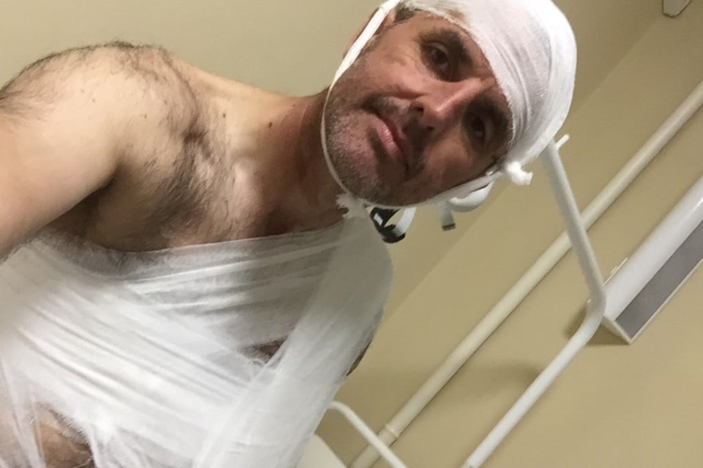 Chris Taylor in hospital in Volgograd, Russia, after his car accident en route to the World Cup.