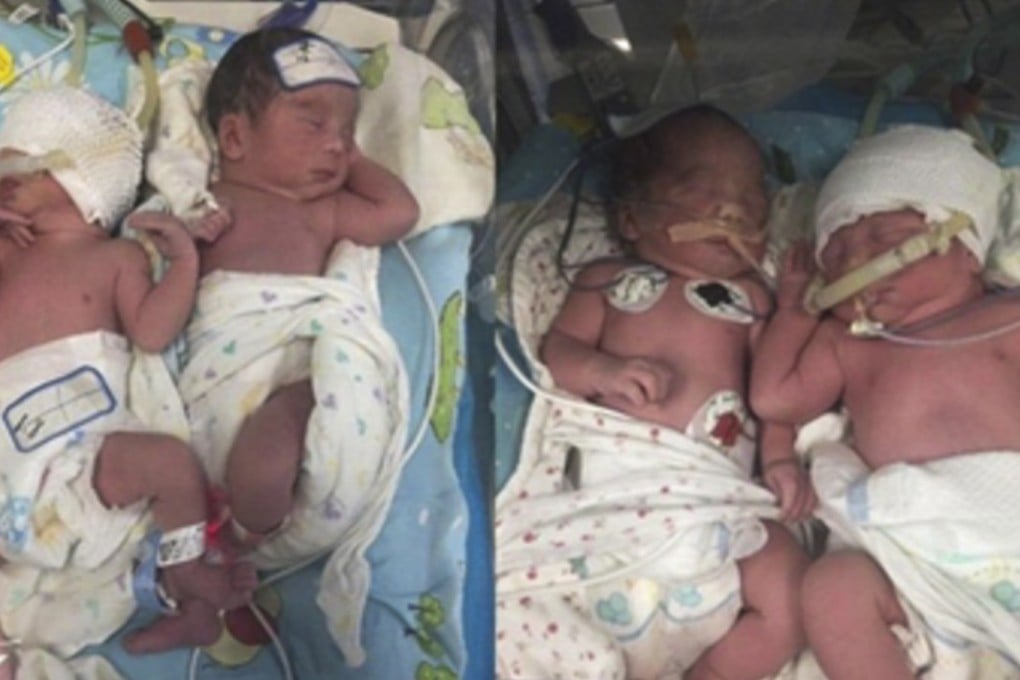 The four babies, one boy and three girls, were born on Friday by caesarean section. Photo: Xnwbw.com