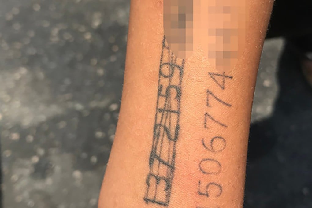 A Chinese woman had her phone numbers tattooed on her son’s arm so people could call her if he got lost. Photo: Qq.com