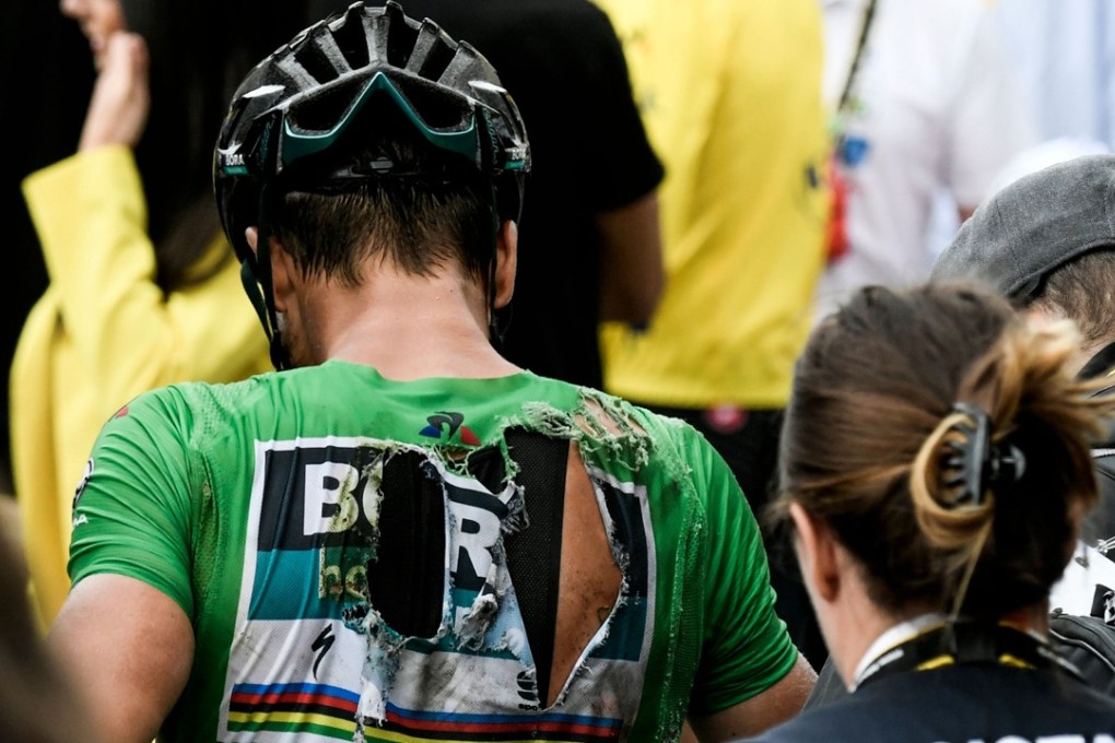 Slovakia’s Peter Sagan, wearing a ripped best sprinter’s green jersey, is pictured after the 17th stage of the 105th edition of the Tour de France, during which he fell, between Bagneres-de-Luchon and Saint-Lary-Soulan Col du Portet. Photo: AFP
