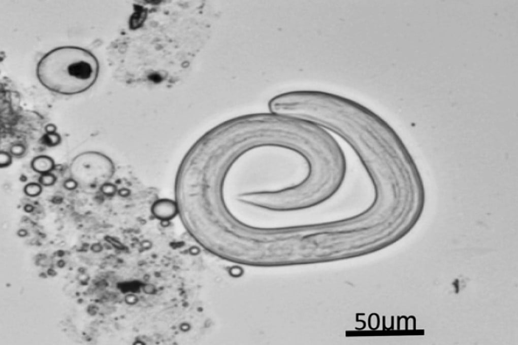 The Angiostrongylus cantonensis parasite, seen here under an optical microscope, was found in a 78-year-old Chinese woman and her 46-year-old son who fell ill after eating live centipedes. Photo: Handout