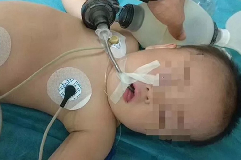 The one-year-old was revived with CPR and is being treated in intensive care. Photo: Changanhome.com