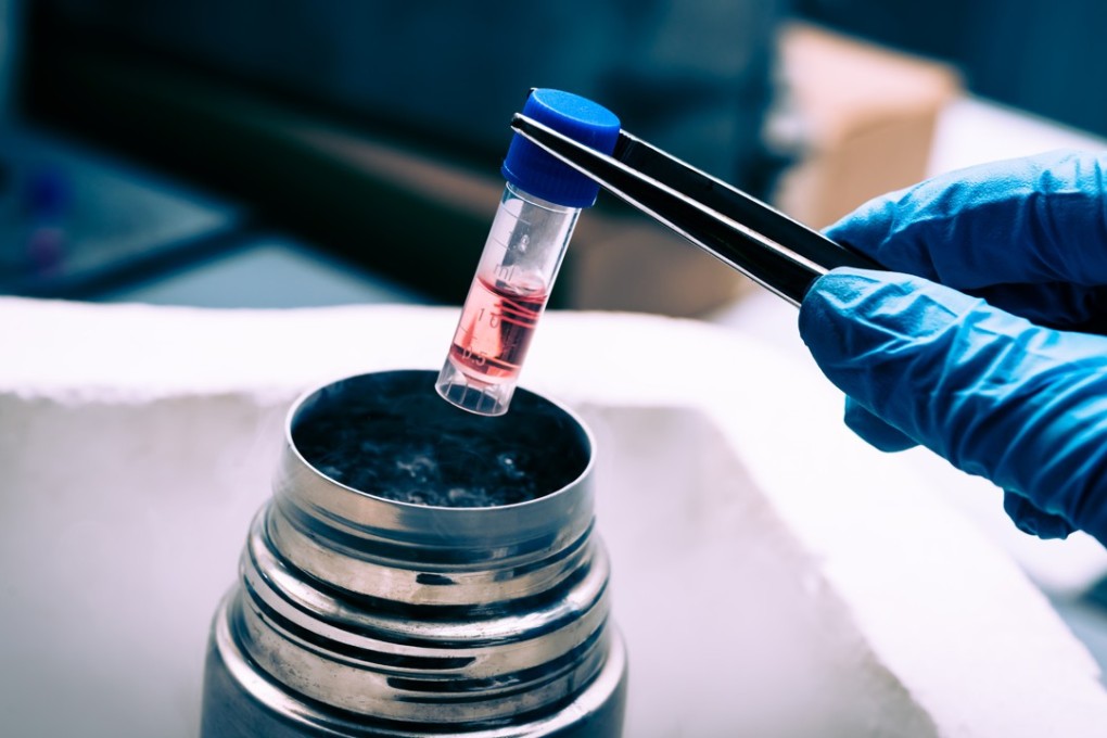 A liquid nitrogen bank containing a suspension of stem cells. The potential uses for stem cells is endless, from increasing longevity to treating cancer and autism, scientists say. Photo: Shutterstock