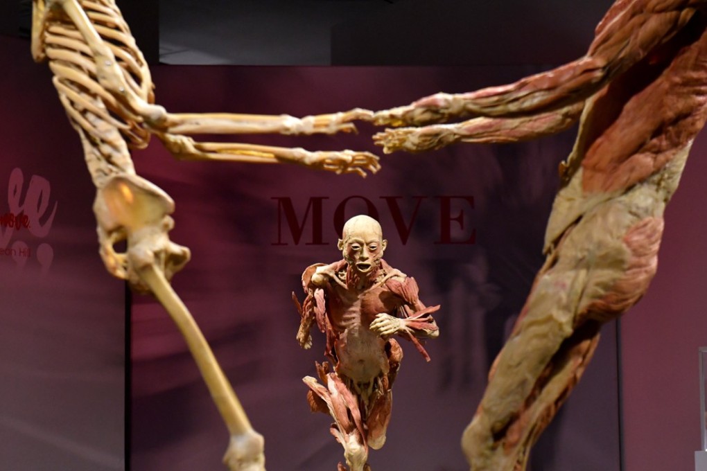 Human remains are seen at the “Real Bodies” exhibition in Sydney, Australia, in April. The travelling anatomical show is currently in Birmingham in Britain. Photo: EPA
