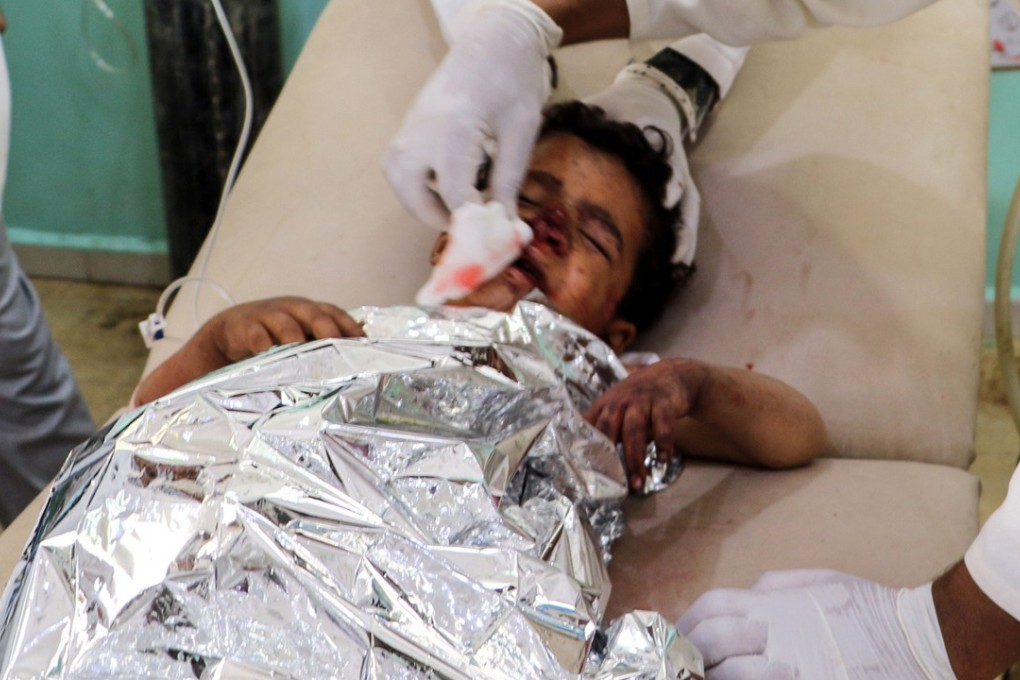 Medics treat a Yemeni child who was injured in a reported air strike. Photo: AFP