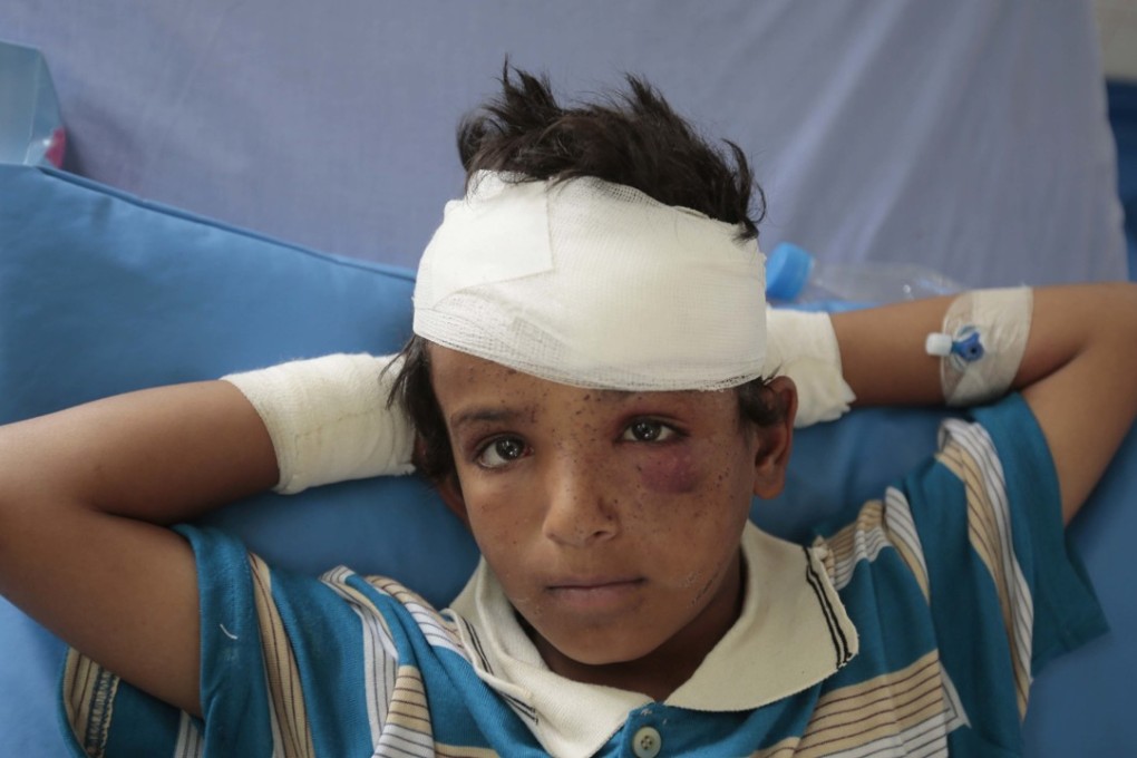 A child injured in a deadly Saudi-led coalition air strike. Photo: AP