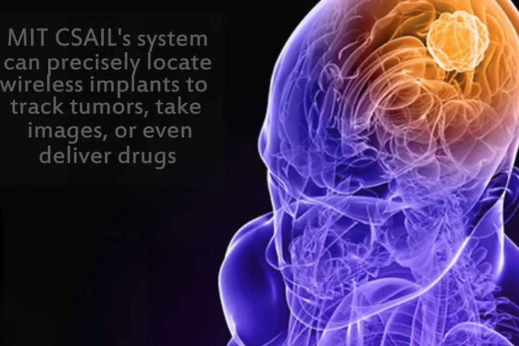 The ReMix system from MIT’s Computer Science and Artificial Intelligence Laboratory could herald a new era in cancer treatment. Photo: YouTube