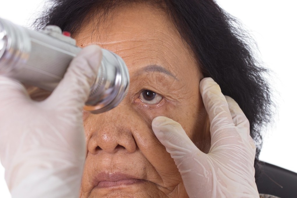 Advances in eye exam technology could help doctors diagnose people with Alzheimer’s disease. Photo: Alamy
