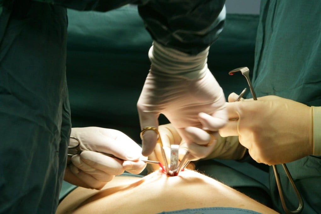 Appendix surgery being performed. Failure to remove an inflamed appendix could result in it perforating, which can lead to peritonitis, a potentially fatal condition.