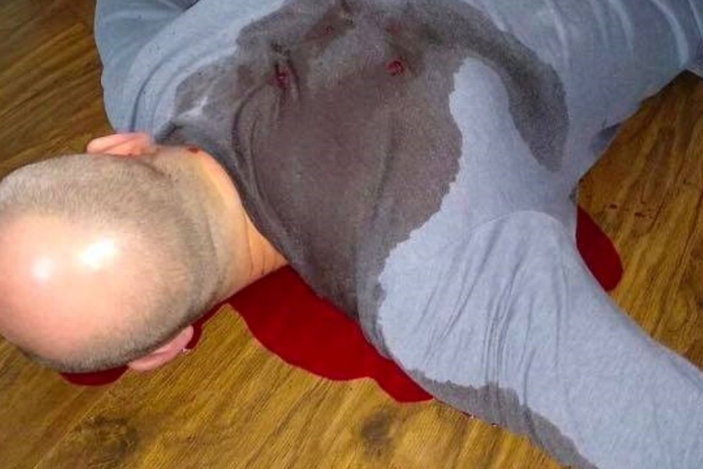 This photo, initially shared on Facebook by a Ukraine lawmaker, purportedly showed Arkady Babchenko lying in a pool of blood. But the photo was faked, and Babchenko unharmed. Photo: Facebook