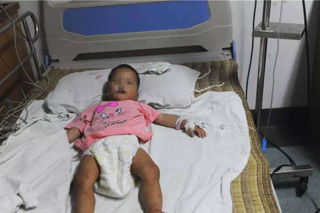 Xiaojiao was found covered in cuts and insect bites but is now recovering in hospital. Photo: Handout