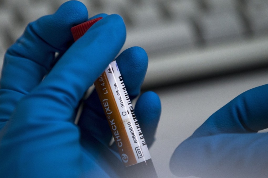 In this May 2016 file photo, an employee of Russia’s national drug-testing laboratory holds a vial in Moscow. Photo: AP
