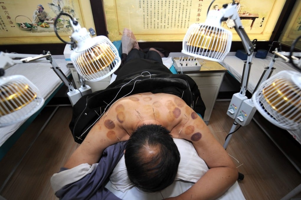 A man receives acupuncture treatment at a hospital in Wuwei, northwest China’s Gansu province. Photo: Xinhua