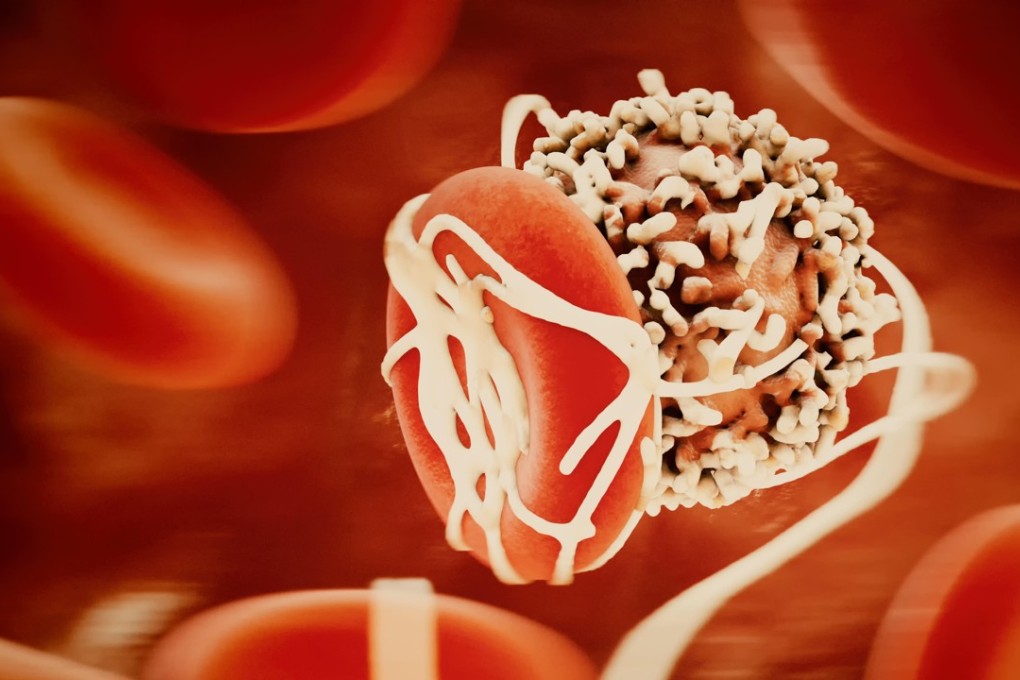 Seventeen cancer drugs have been made available through China’s national public health insurance after price cuts. Pictured, a cancer cell. Photo: Alamy