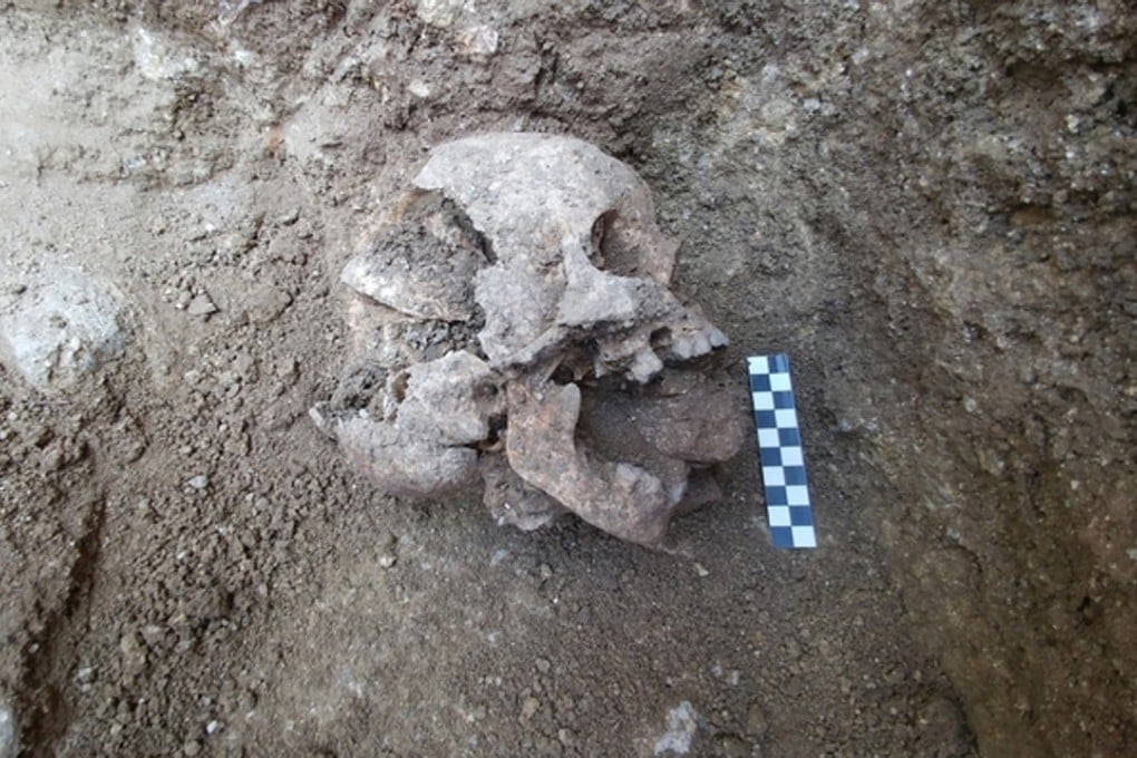 The remains of a 10-year-old buried during the fifth century in an ancient Roman cemetery in Italy's Umbria region. Researchers believe the child died of malaria and a stone was deliberately inserted into the mouth after death to prevent the child from rising from the dead. Photo: David Pickel/Stanford University