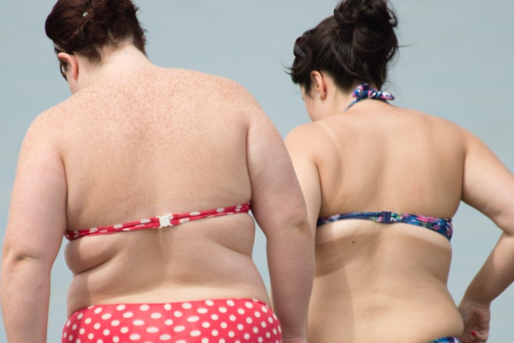 Brown fat may hold the key to fighting obesity because it burns off energy, whereas white fat stores it. Photo: Alamy