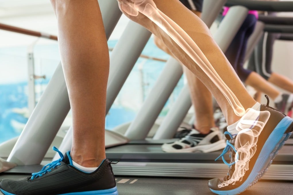 People’s bone mass peaks when they are in their mid-30s, and when women approach menopause they will experience a period of rapid loss in bone mass. Photo: Shutterstock