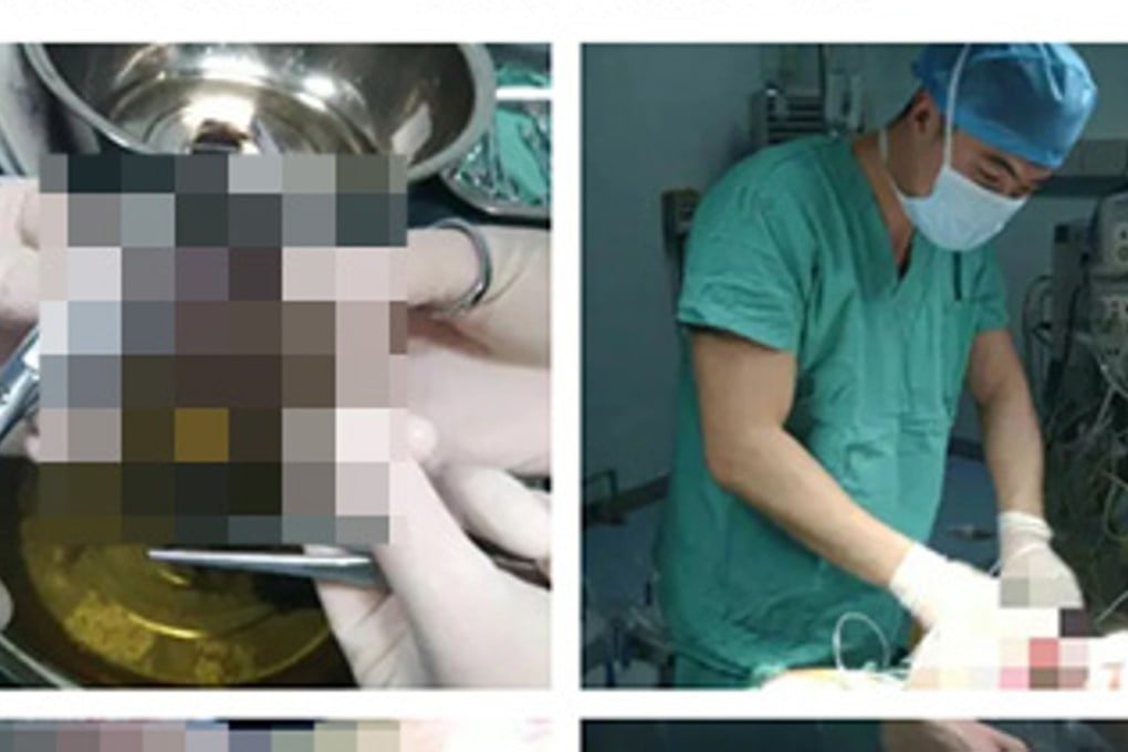 Two of the pixelated photos of the wounds a child suffered in an attack by dogs that were reposted by an animal rights group, which accused the hospital of increasing tensions between humans and dogs. Photo: Thepaper.cn
