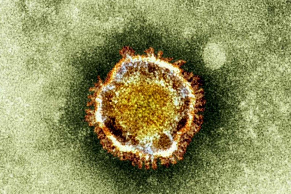 An electron microscope image of a coronavirus, part of a family of viruses that cause ailments including the common cold. Photo: AP