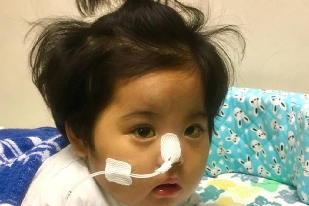 Baby girl Yuyan, who suffered cardiac arrest following liver surgery, has now found a suitable organ donor who is willing to give her a new liver. This picture of Yu-yan was published on the Facebook page “Yu-yan recovery”. Photo: Facebook