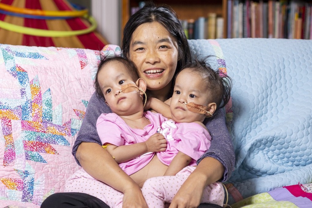 Bhumchu Zangmo hugs her conjoined twins Nima and Dawa at Miracle sMiles Retreat in East Kilmore, Australia, on Friday. Photo: EPA