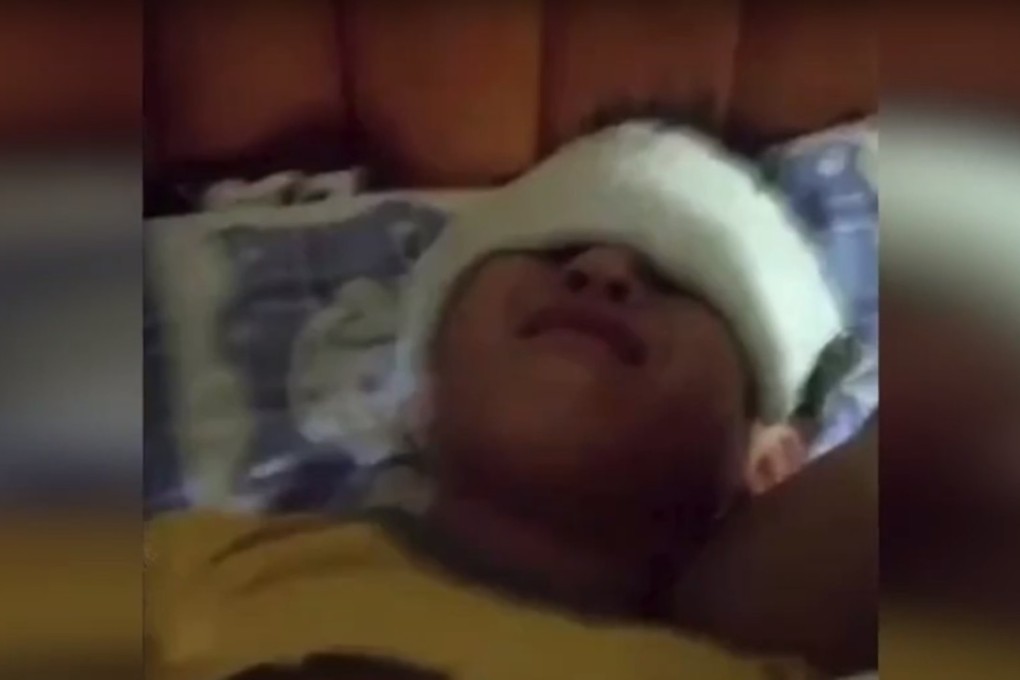 Photo on Weibo shows a boy with damage to his eyes. Photo: Weibo