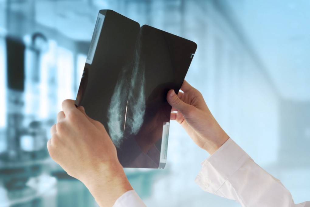 Types of the disease expected to see the biggest rise in Hong Kong included colorectal, breast and lung cancers.