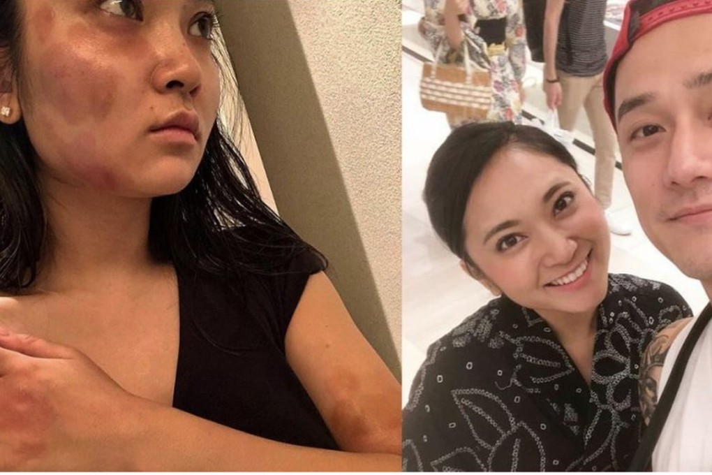 Haruka Nakaura posted photos of her bruises, after which Jiang Jinfu (right) admitted to hitting her. Photo: Shanghai.ist