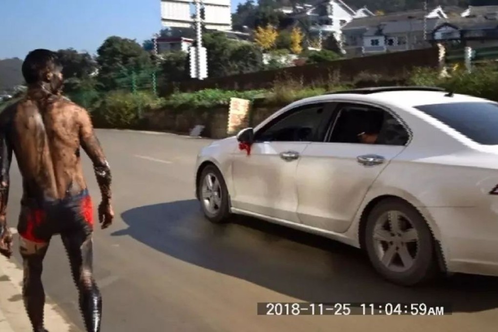 A bridegroom in southern China suffered multiple injuries after being hit by a car while crossing a highway to escape mistreatement from his friends as part of one of China’s notorious wedding hazing rituals. Photo: Sohu